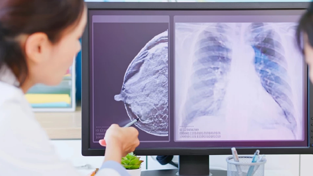 โรช ไทยแลนด์ พลังเสียงกู้ชีพ! ฉลองเดือนผู้รอดชีวิตจากมะเร็ง