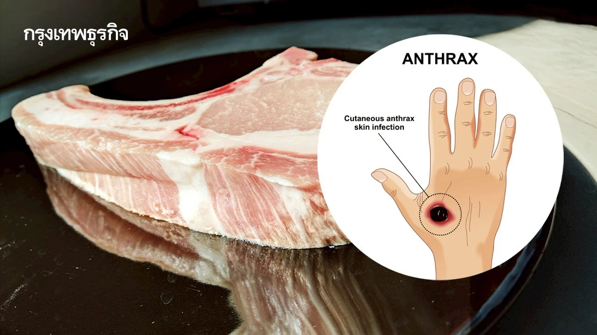 'แอนแทรกซ์' ถึงสระแก้วแล้ว รู้หรือไม่ใครเสี่ยง? สสจ. เร่งสอบสวน