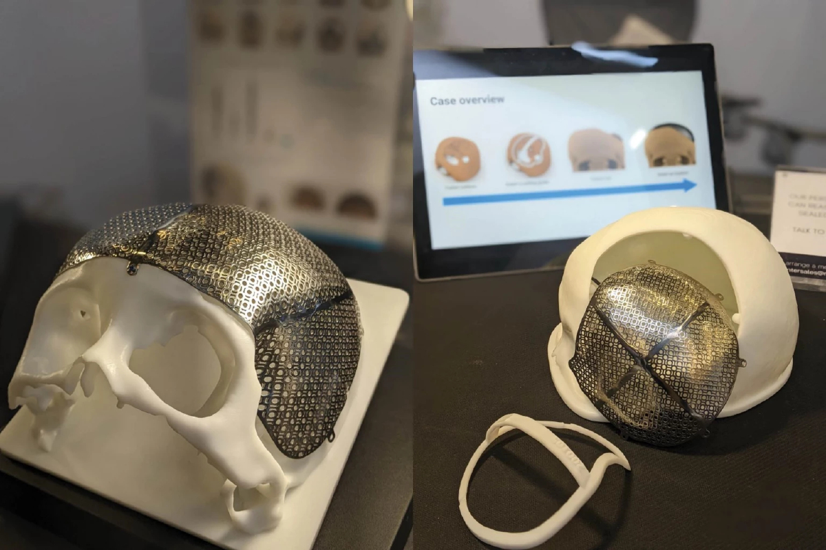 'บัตรทอง' มุ่งใช้ผลิตภัณฑ์การแพทย์ 'บัญชีนวัตกรรมไทย' ยกระดับดูแล