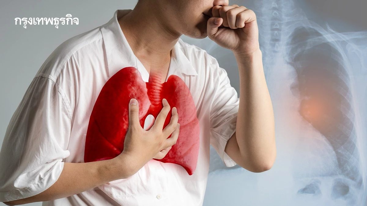 สัญญาณเตือน 'มะเร็งปอด' เสียงแหบ 1 ในอาการ ปัจจัยเสี่ยงมากกว่าบุหรี่