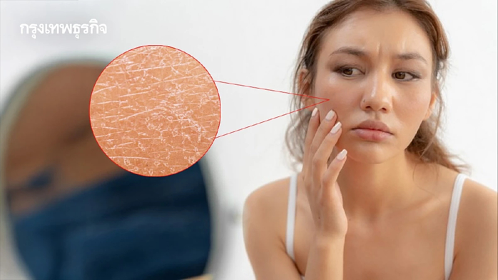 'หน้าลอกเป็นขุย' สัญญาณอันตรายที่มาจากภูมิแพ้ -เครื่องสำอาง