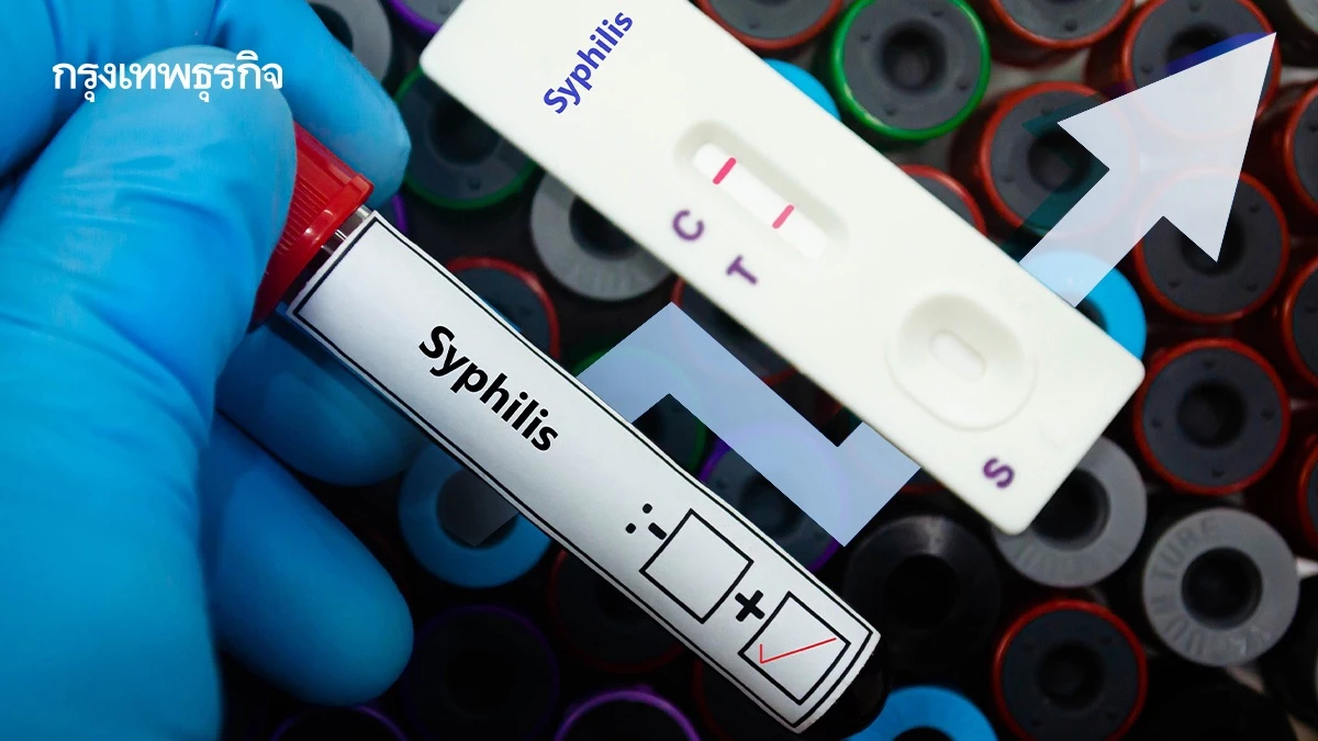 ซิฟิลิสพุ่งแรงกว่า 2.9 เท่า ใน 5 จังหวัด พ่อแม่วัยใสรับความเสี่ยง