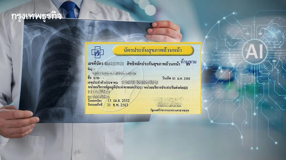 บัตรทองอัปเกรด!ดัน 'AI อ่านฟิล์มเอกซเรย์' นำร่องรพ.รัฐ 157 แห่ง
