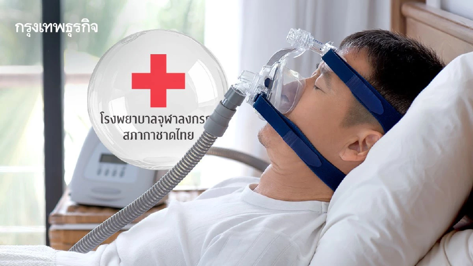 รพ.จุฬาฯ สร้างประวัติศาสตร์! ผ่าตัดรักษา โรคหยุดหายใจขณะหลับ สำเร็จ