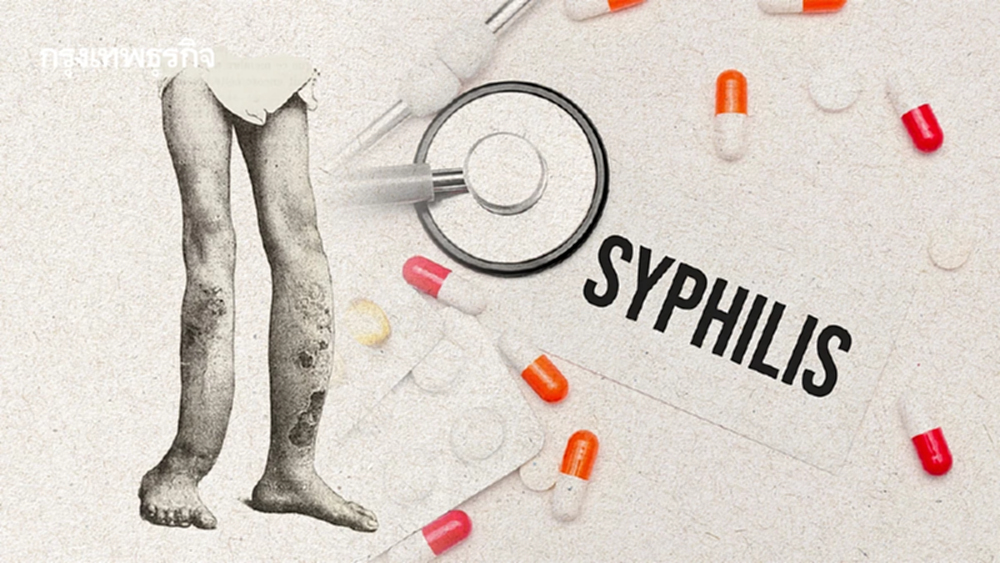 10 จังหวัดเสี่ยง 'โรคขาดาบ' เด็กติดเชื้อซิฟิลิสตั้งแต่กำเนิด