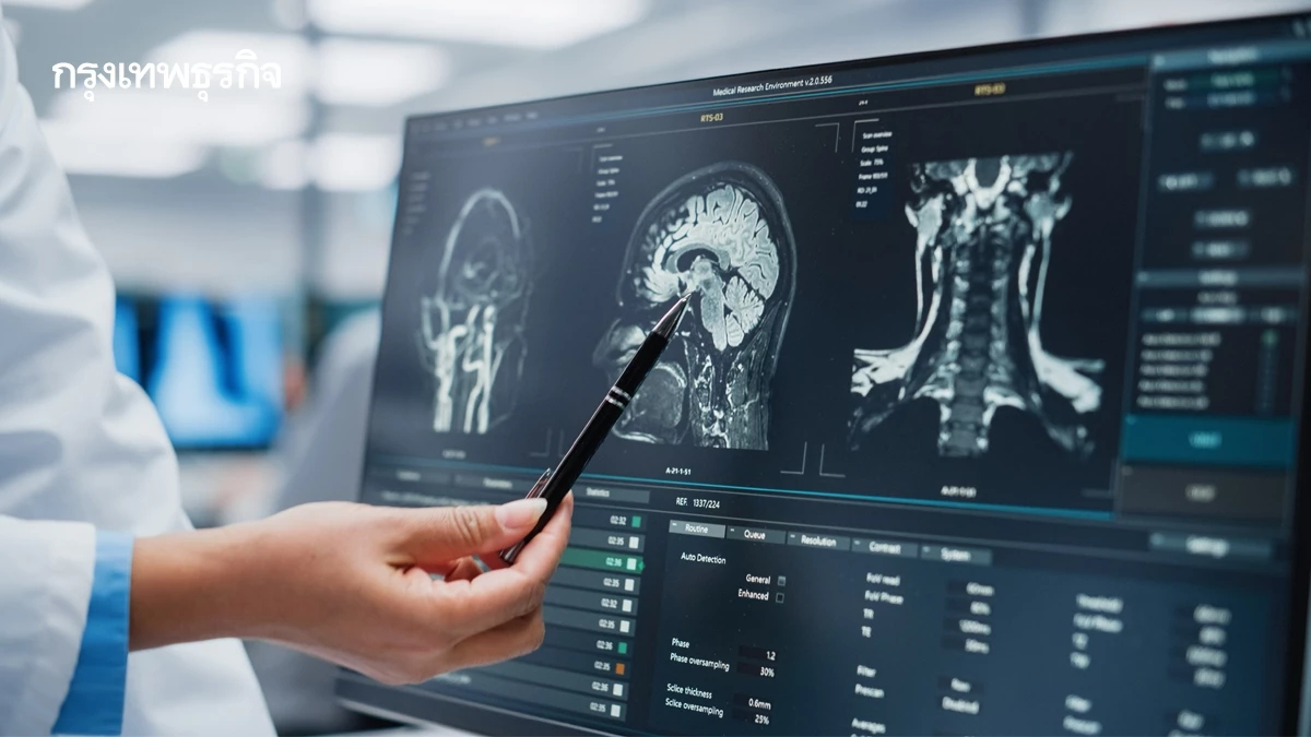 ไขคำตอบ จากแพทย์ เป็นไปได้แค่ไหน 'เสมหะ' จุดเริ่มต้นของเนื้องอก