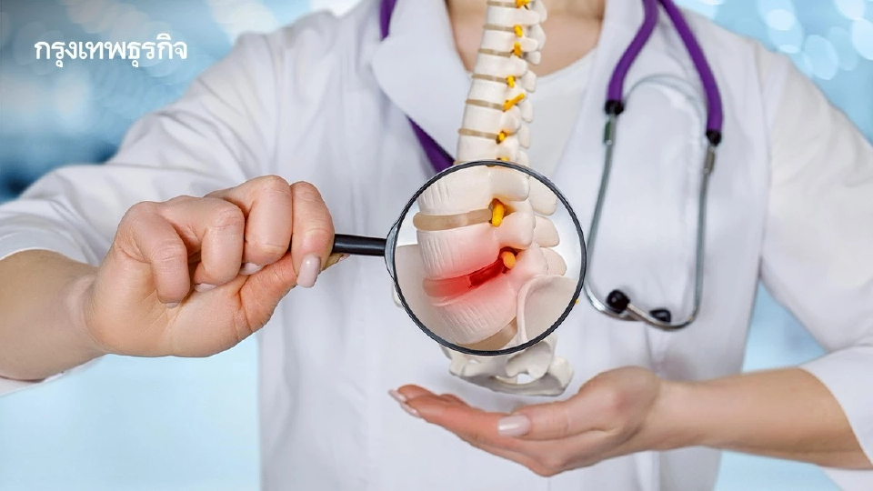 ภัยร้าย! ความเครียด ส่งผล 'กระดูกบางเกิดโรคกระดูกพรุน'