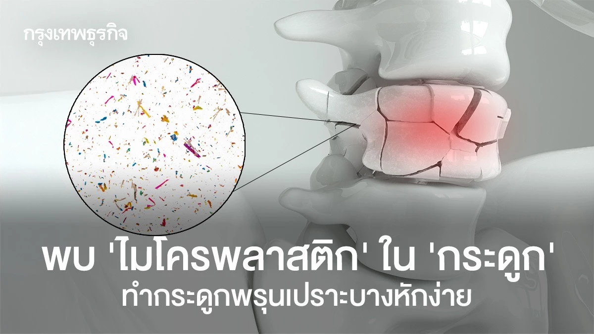 Microplastic Contamination: Bones Breaking, Fragility Explained