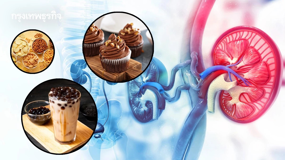 กินไม่เค็มก็เสี่ยงโรคไต 'อาหารแปรรูป-เบเกอรี่-ชานมไข่มุก' แหล่งโซเดียม