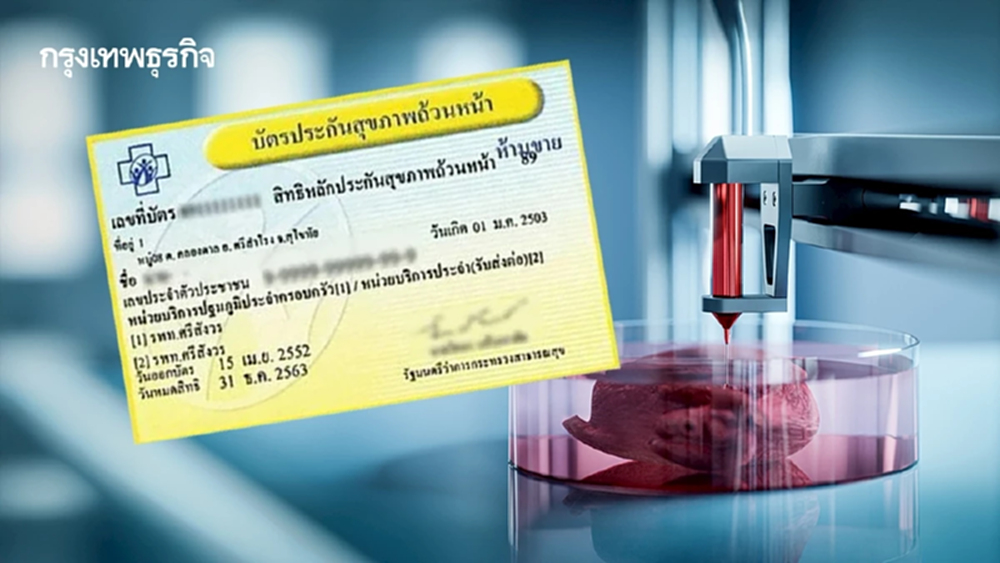 บัตรทอง เฮ สปสช. เพิ่มรักษามะเร็งหญิง 5 กลุ่มโรค ด้วย 3D Printing