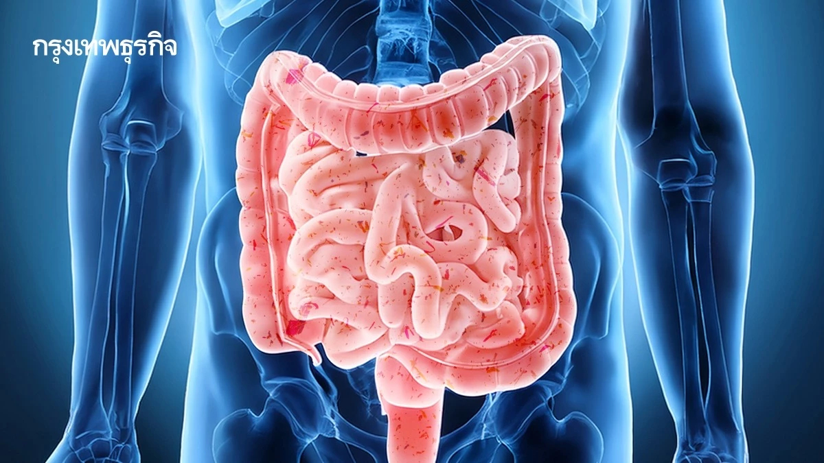 ‘ไมโครพลาสติก’ เปลี่ยนแปลง ‘แบคทีเรียในลำไส้’ มีน้อยลง เป็นกรดมากขึ้น ทำลำไส้อ่อนแอ