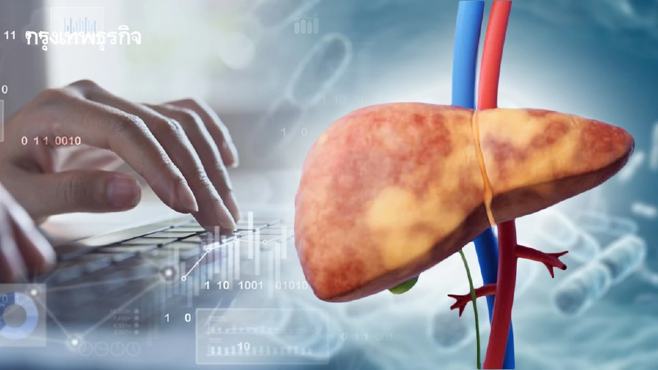 ‘ปตท.-ที.แมน’รุกโพรไบโอติก ลุยตลาดป้องกันไขมันพอกตับ