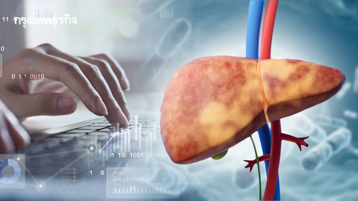 ‘ปตท.-ที.แมน’รุกโพรไบโอติก ลุยตลาดป้องกันไขมันพอกตับ