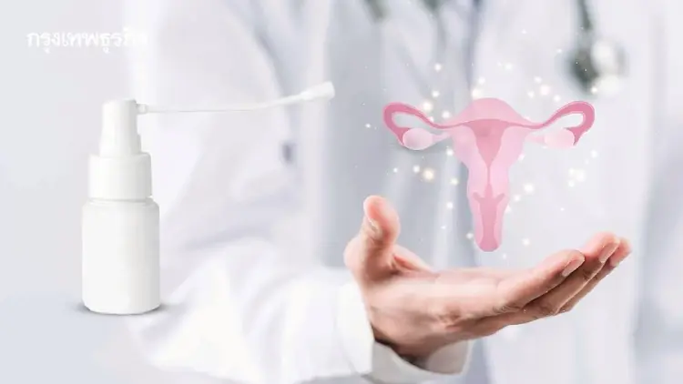‘เจลสเปรย์ช่องคลอด’ เร่งสปีดหายติดเชื้อ HPV ต้นเหตุมะเร็งปากมดลูก