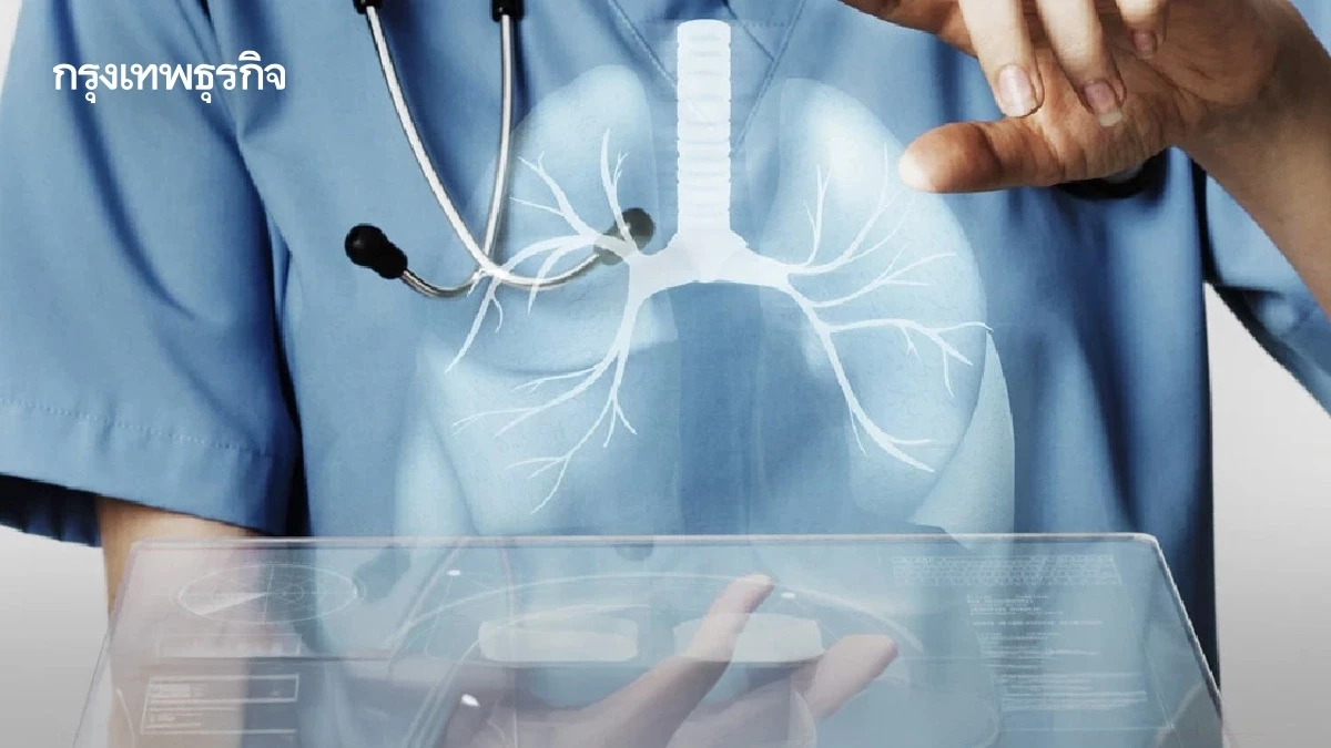 ‘HRCT Checklist’ ดิจิทัล ติดอาวุธรังสีแพทย์ – แพทย์ สู้ 'โรคไอแอลดี'