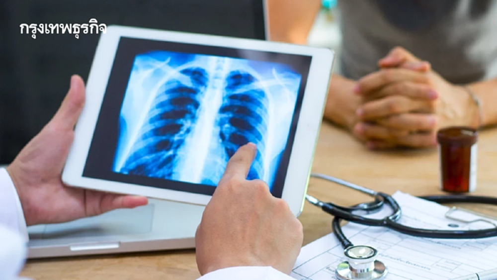 บัตรประชาชนใบเดียว ตรวจเอกซเรย์ปอดเคลื่อนที่ กทม. ตลอดพฤศจิกายน