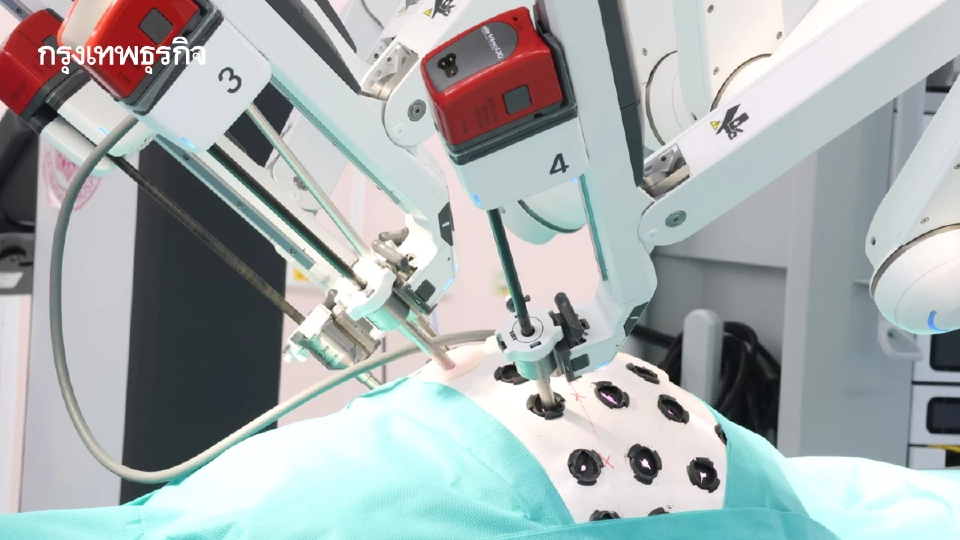 3 โรคมะเร็ง 'หุ่นยนต์ผ่าตัด' รักษาฟรี  ‘รพ.ราชวิถี’ เคสมากสุดในไทย