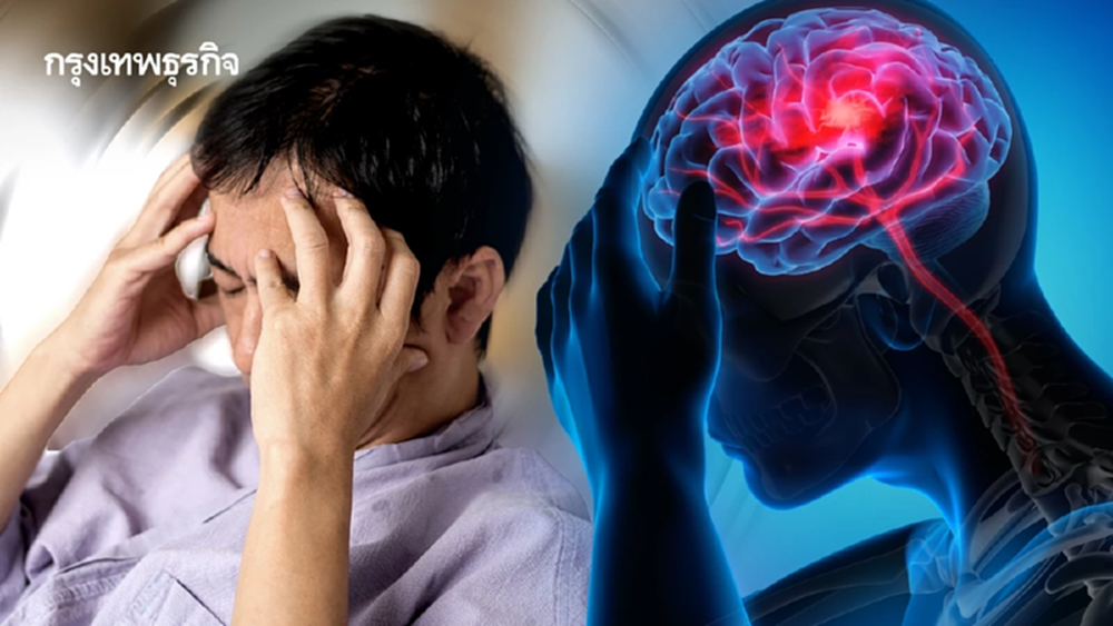 ‘Mini Stroke‘ สัญญาณเตือน ก่อนเส้นเลือดสมองจะชัตดาวน์