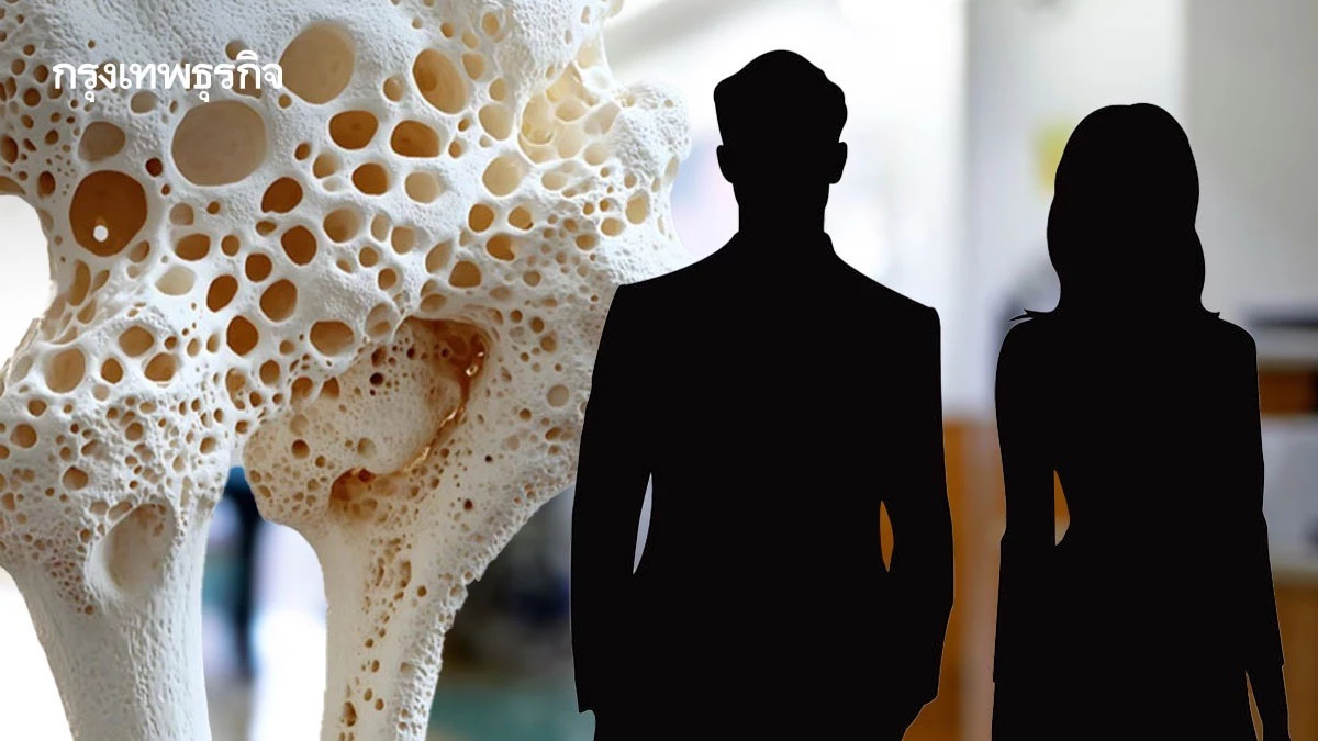 เสี่ยงเท่ากัน! ชายไทยอย่าชะล้าใจ 'กระดูกพรุน' ไม่ใช่เรื่องของผู้หญิง