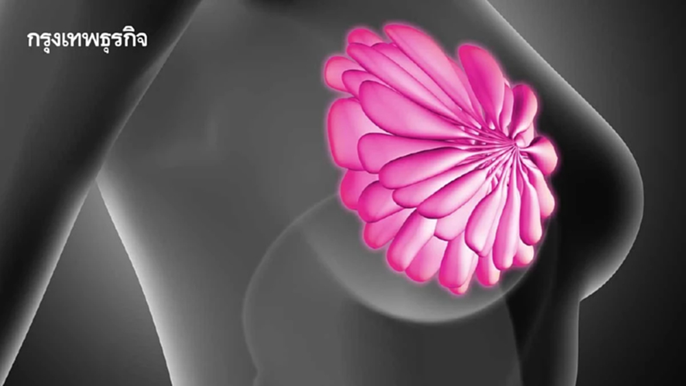 สุดล้ำ! 'Thermogram' เทคโนโลยี AI ตรวจคัดกรองมะเร็งเต้านม