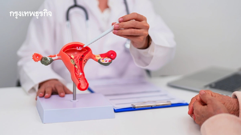 รวมความเชื่อผิดๆ  เกี่ยวกับ 'มะเร็งปากมดลูก' VS ข้อเท็จจริง