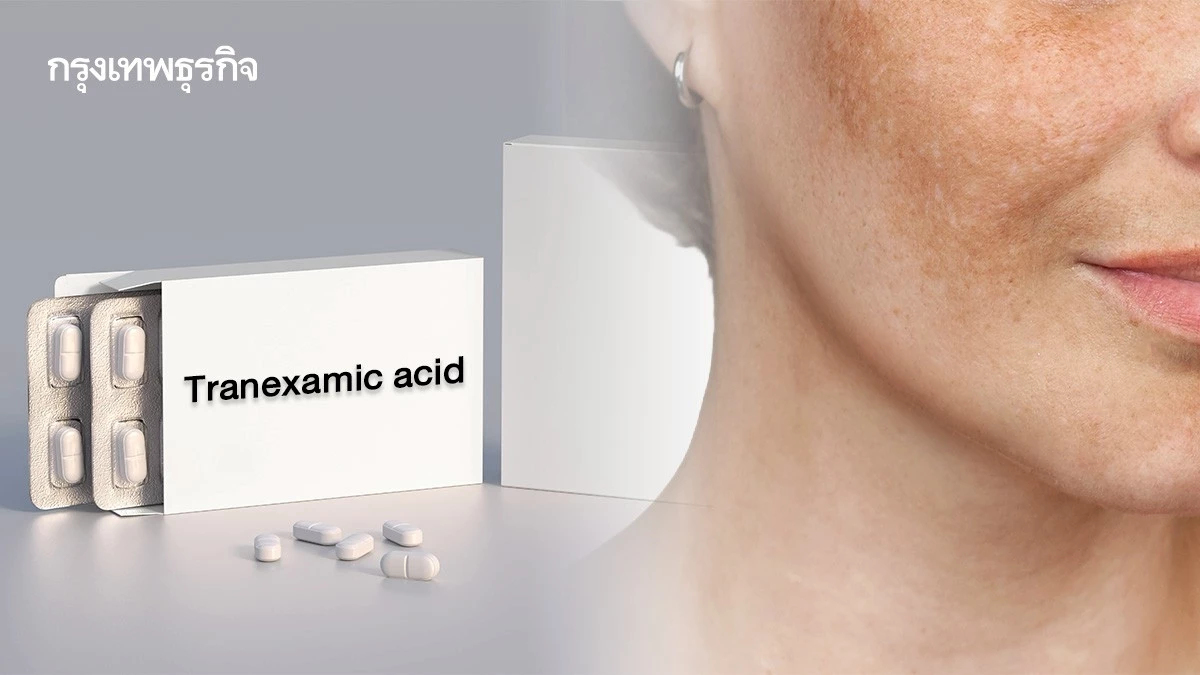 สิ่งที่ต้องรู้ก่อนใช้! ’Tranexamic acid’ จาก ‘ยาห้ามเลือด’สู่ ‘ยาแก้ฝ้า