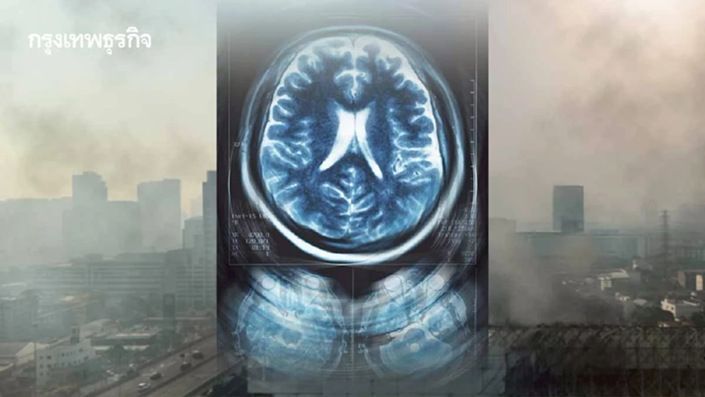 PM 2.5 เกิดภาวะสมองฝ่อก่อนวัย คนเป็นโรคอัลไซเมอร์หรือพาร์กินสันเร็วขึ้น