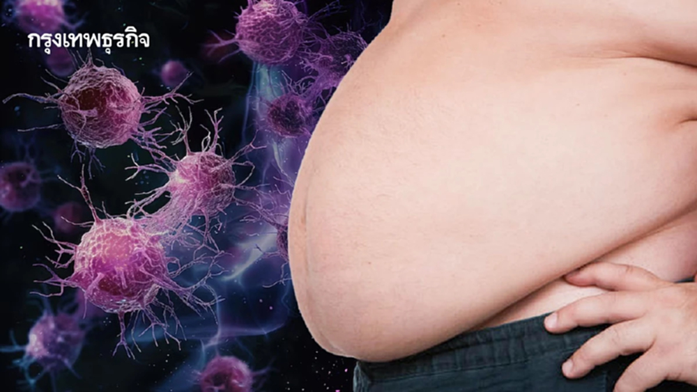 ‘ความอ้วน’ เพิ่มเสี่ยง ‘โรคมะเร็ง’ 13 ชนิด ชูพืชผักพื้นบ้านต้านอนุมูลอิสระ