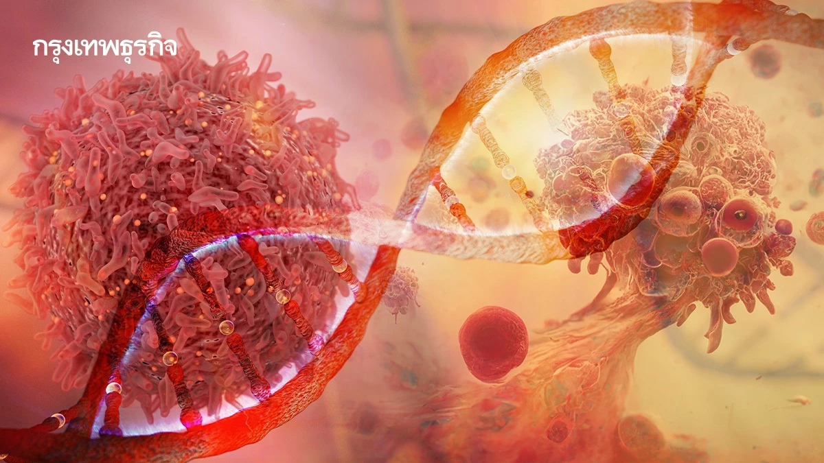 ‘คาร์ ที-เซลล์’ ยีนบำบัดรักษามะเร็ง แม้ได้ผลแต่ไม่ใช่ใช้ในผู้ป่วยทุกราย