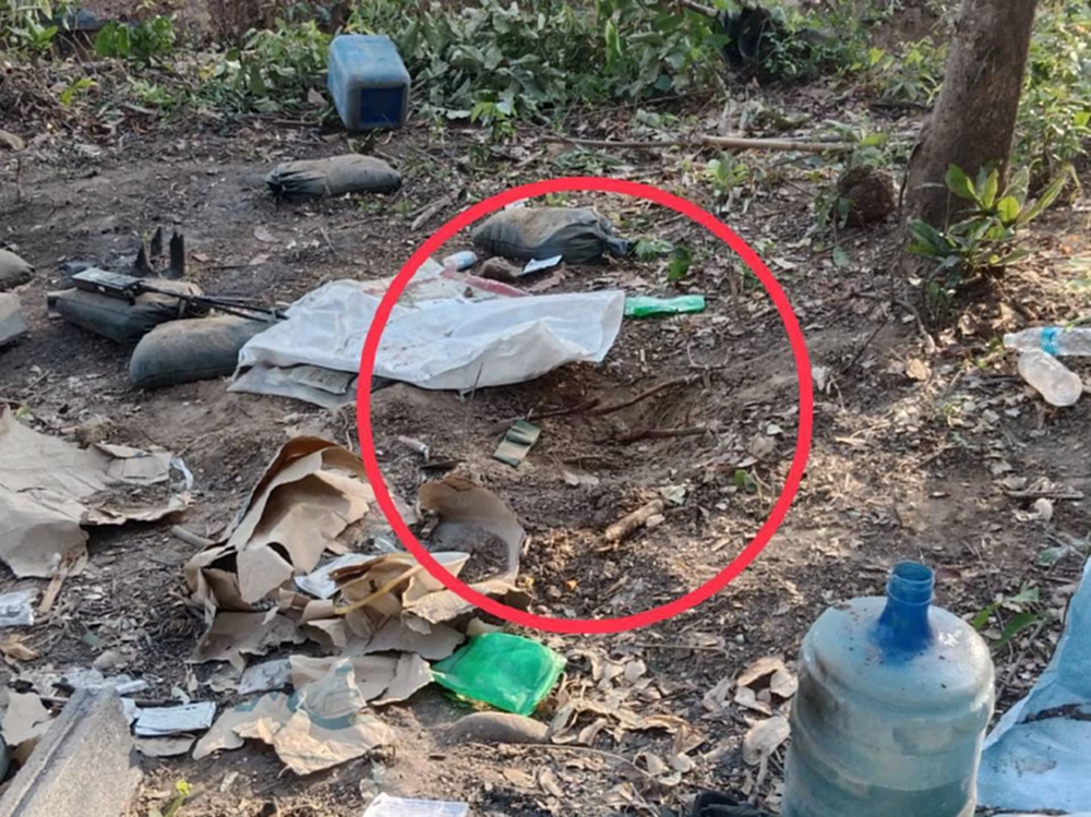 ทภ.2 แจง พลทหาร เหยียบกับระเบิดสาหัส ขาซ้ายขาด ขาขวาแผลฉีกขนาดใหญ่