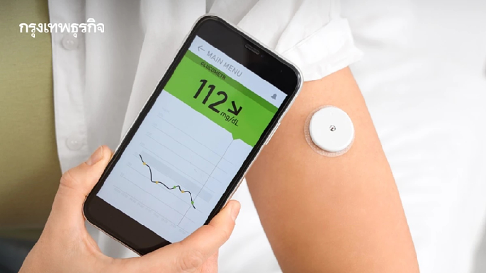 เทรนด์ CGM เครื่องตรวจระดับน้ำตาลแบบต่อเนื่อง รับกระแสสุขภาพใหม่ที่ต้องวัดได้