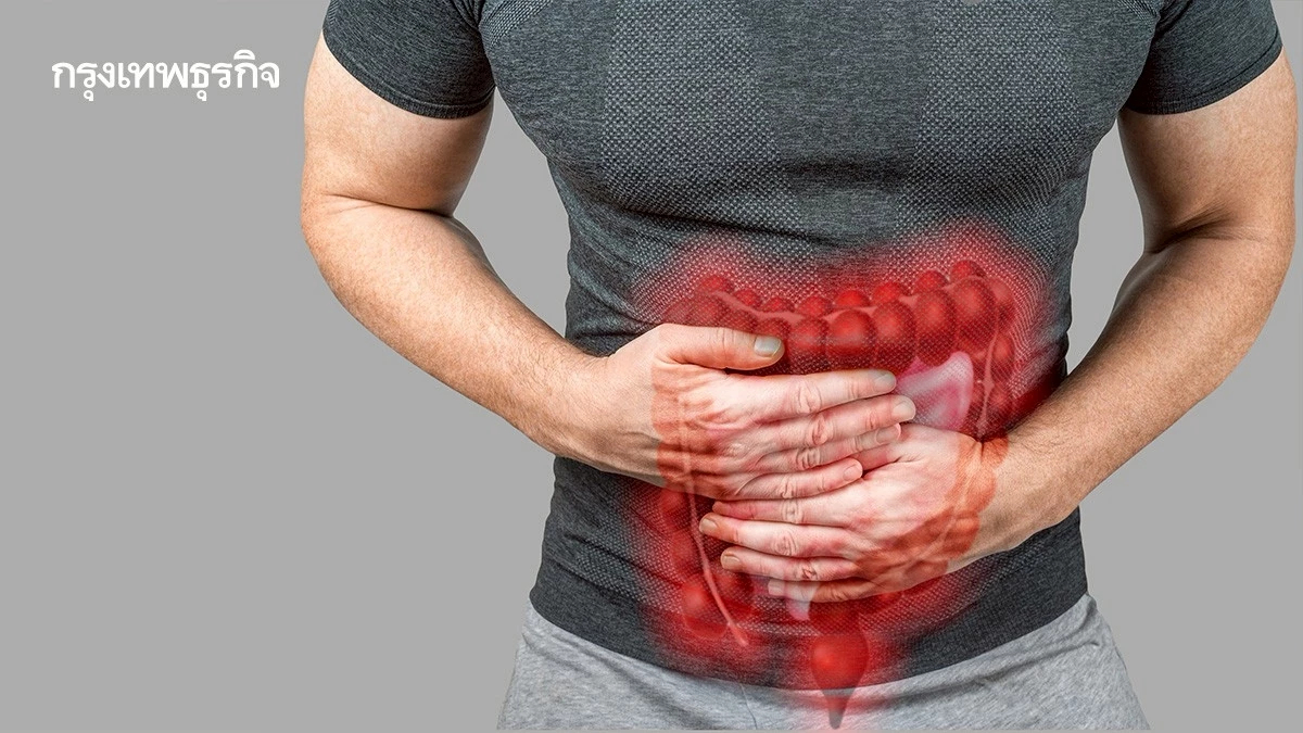 ‘มะเร็งลำไส้ใหญ่และไส้ตรง’ ไทยพบเพิ่ม อาการเริ่มต้นเงียบ ๆ