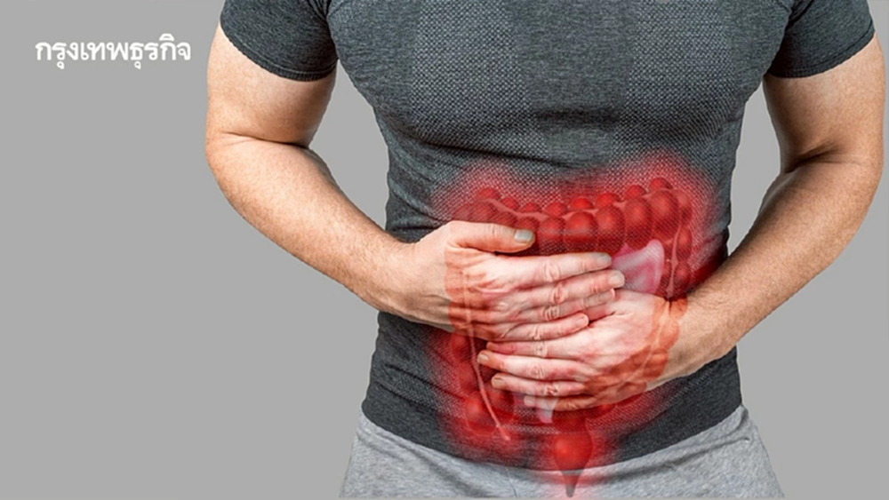 ‘มะเร็งลำไส้ใหญ่และไส้ตรง’ ไทยพบเพิ่ม อาการเริ่มต้นเงียบ ๆ