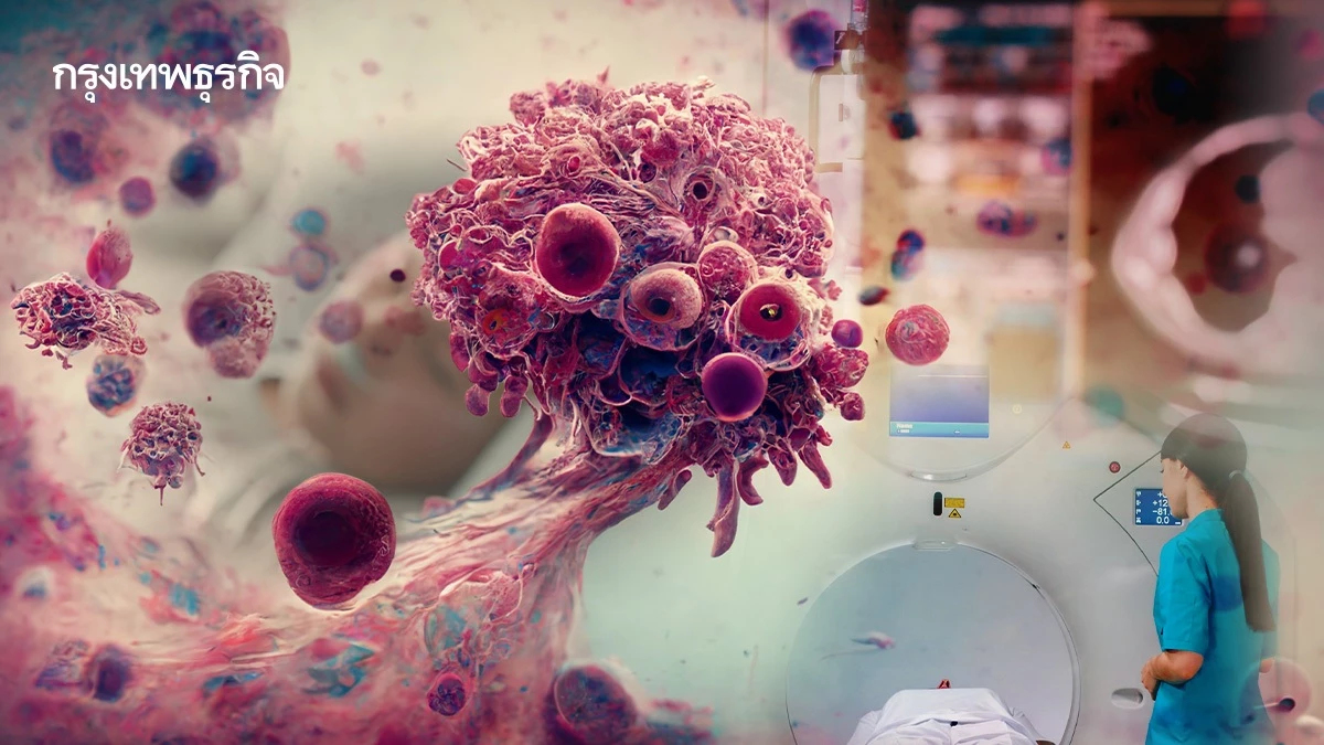 สธ.เล็งออก 'พ.ร.บ.โรคมะเร็ง' บังคับใช้ครั้งแรก หลังยอดป่วยพุ่ง
