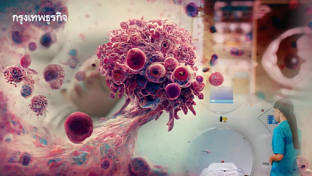 สธ.เล็งออก 'พ.ร.บ.โรคมะเร็ง' บังคับใช้ครั้งแรก หลังยอดป่วยพุ่ง