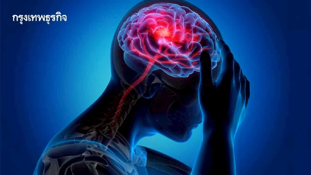 กรมการแพทย์ แนะสังเกตุ 5 อาการ เลือดออกในสมองจากเส้นเลือดสมองแตก