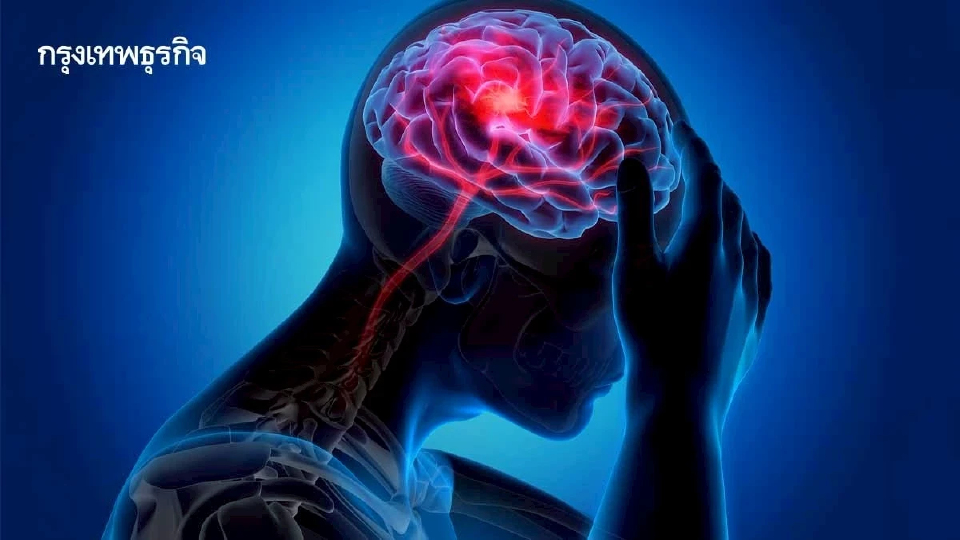 กรมการแพทย์ แนะสังเกตุ 5 อาการ เลือดออกในสมองจากเส้นเลือดสมองแตก