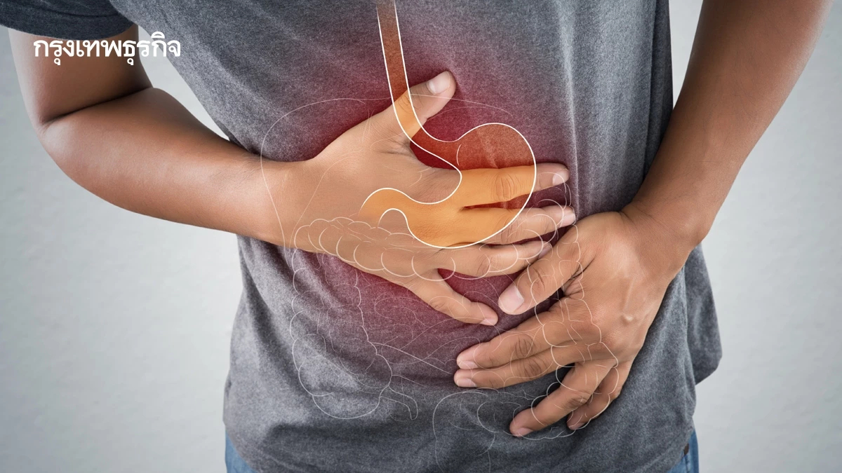 คกก.นโยบายโรคมะเร็ง เคาะเป้าส่องกล้องตรวจมะเร็งลำไส้ใหญ่ครอบคลุม 80 %