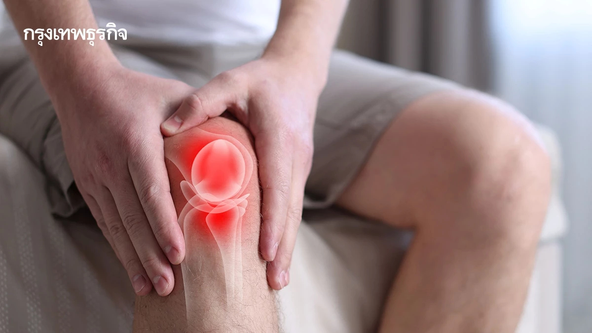 'สเต็มเซลล์รักษาข้อเข่าเสื่อม' ไม่ใช่มาตรฐานการรักษา