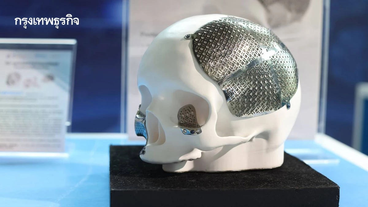 สปสช.เปิดแผน 2 ปี ใช้นวัตกรรมไทยระบบบัตรทอง 1.5 หมื่นล้าน