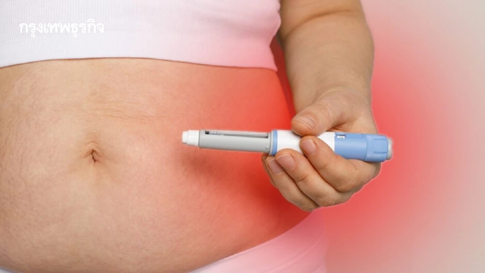 เตือนภัย ‘ปากกาลดน้ำหนัก’ ย้ำเป็นยาอันตรายใช้รักษาโรค