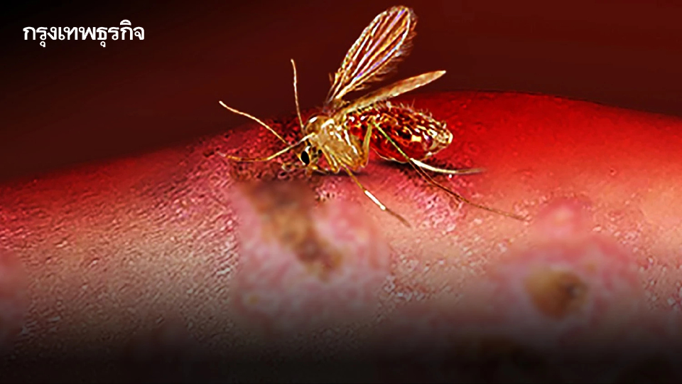เตือน 'โรคลิชมาเนีย' ภัยร้ายจาก 'ริ้นฝอยทราย' แมลงตัวจิ๋วแต่พิษสงร้ายกาจ