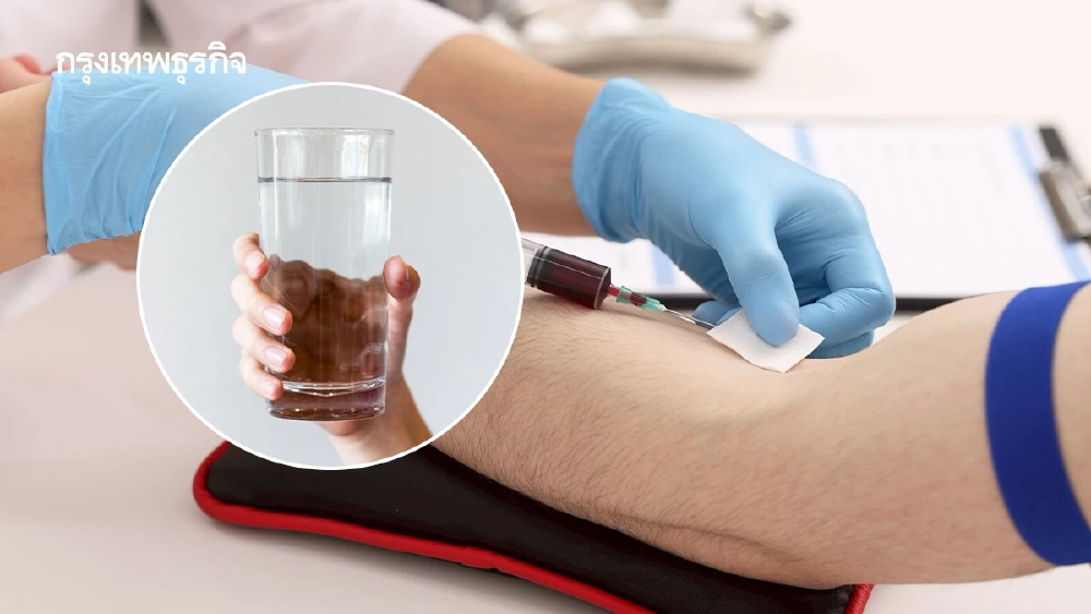 หลายคนเพิ่งทราบ ก่อนเจาะเลือด 'ดื่มน้ำเปล่า' ได้  งดอาจทำ 'ผลตรวจคลาดเคลื่อน'