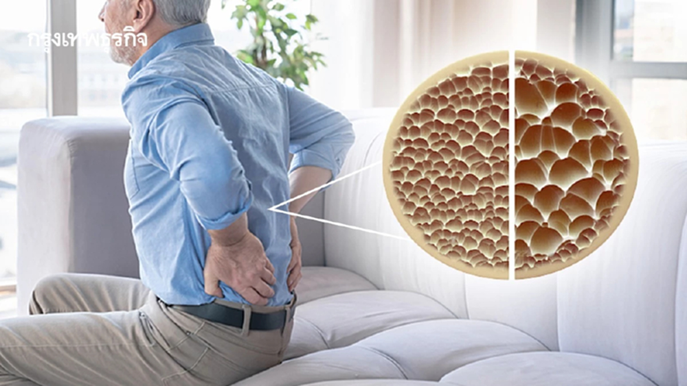 ไม่ล้มก็เสี่ยง! ความจริงกระดูกสันหลังยุบจากกระดูกพรุน ภัยเงียบสูงวัย