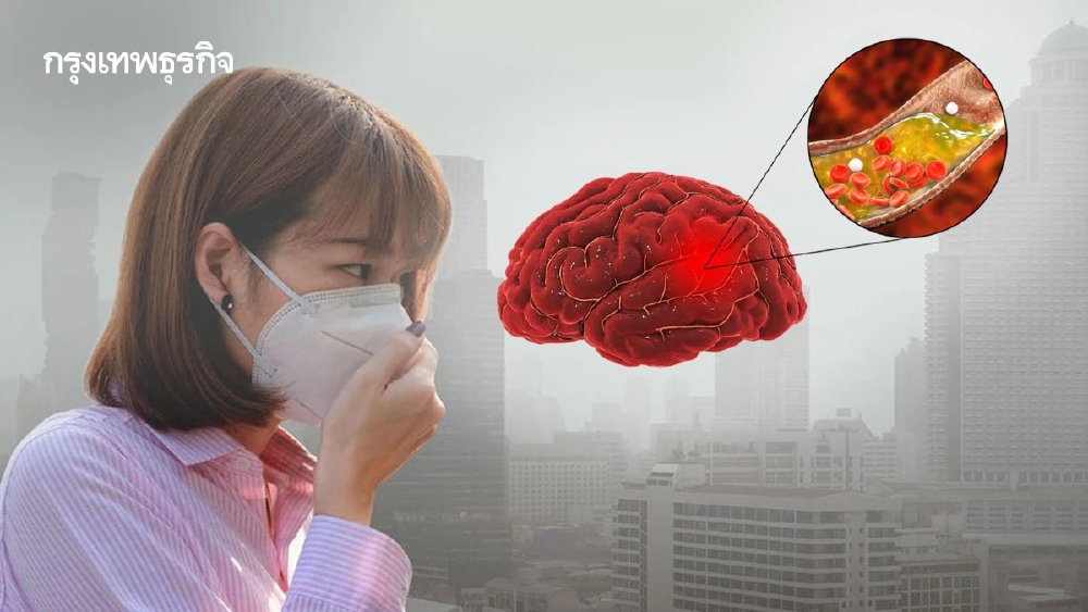 ผลวิจัยชี้ PM2.5 เล็กทะลุสมอง เสี่ยง 'หลอดเลือดตีบตัน สมองเสื่อม'