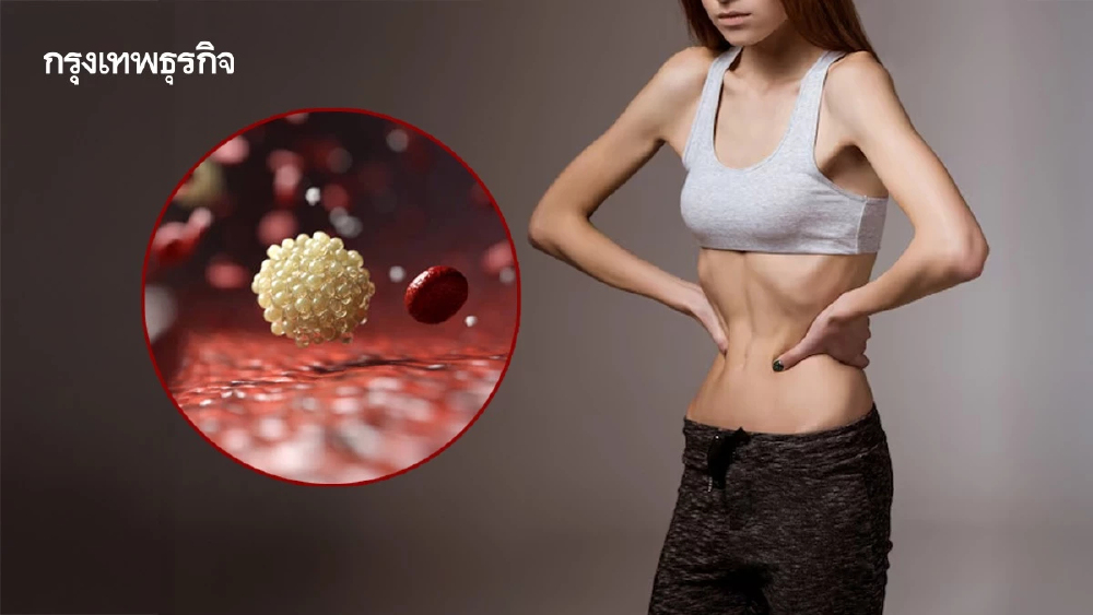 กินน้อย ผอม แต่ไตรกลีเซอไรด์พุ่ง เปิดสูตรลดไตรกลีเซอไรด์ ลดโรค