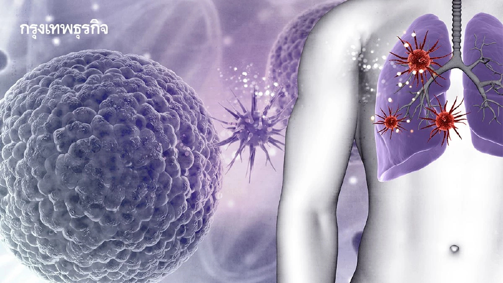 เตือน ไวรัสตับอักเสบเอ! ใช้สูตร 4 ประการป้องกันติดเชื้อไม่รู้ตัว