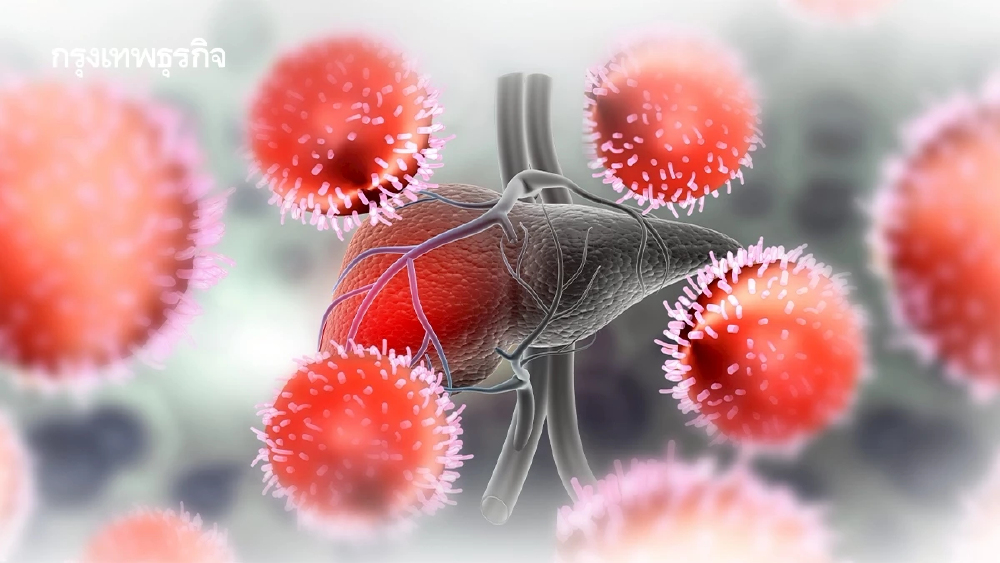 เตือน ตับอักเสบเอ พุ่ง 2 เท่า ระบาด 'กทม.-ตะวันออก' เช็กอาการด่วน!