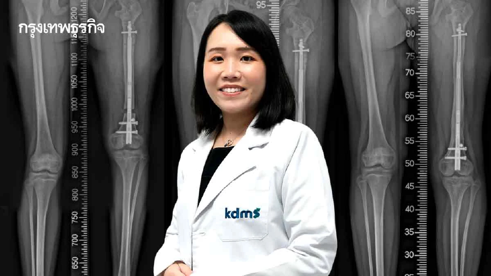 ผ่าตัด 'ยืดกระดูก' เพิ่มโอกาสการใช้ชีวิต  นวัตกรรมแก้เข่าโก่ง เข่าเก เพิ่มสูง
