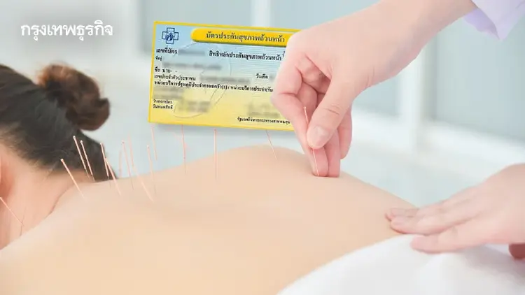 กางสิทธิบัตรทอง 2569 'แพทย์แผนไทย-ฝังเข็ม' รักษาฟรี มีอะไรบ้าง